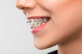 Align Your Smile with Prestige Dental, Fort Worth