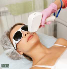 Laser Full Body Hair Removal in Dubai- Ecla Clinic, Dubai