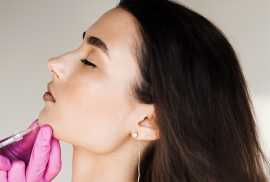 Chin Augmentation in Sacramento - Aesthetic Envy, Sacramento