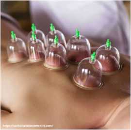 Art of Cupping Exploring the Benefits of Hijama, Mumbai