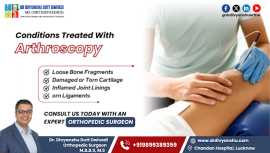 Arthroscopy surgery in Lucknow | Dr Divyanshu Dutt, Lucknow
