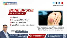 Bone Bruise and its Symptoms by Dr. Divyanshu Dutt, Lucknow