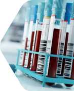 AV Consumable Vacuette Blood Collection Set, Ahmedabad