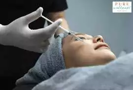 Enhance Your Natural Beauty with Dermal Fillers, Ocala