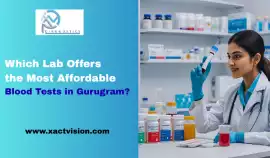 Which Lab Offers the Most Affordable Blood Tests i, Adin