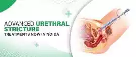 Top Doctors for Urethral Stricture in Noida, Noida