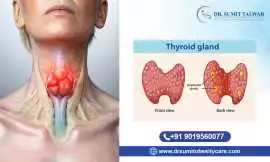 Best Robotic Thyroid Surgeon in Bangalore , Bengaluru