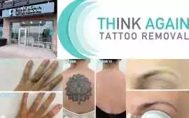 Think Again Tattoo Removal, Austin