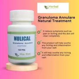 Herbal Supplement for Granuloma Annulare, Abbeville