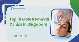Trusted Mole Removal in Singapore – Expert Care, Bukit Timah