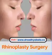Affordable Rhinoplasty Surgery in Bangalore, Bengaluru