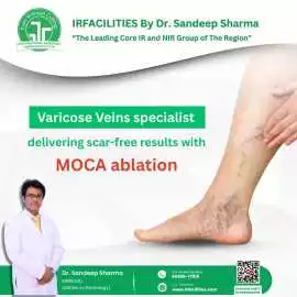 Experienced Varicose Veins Specialist , Chandigarh
