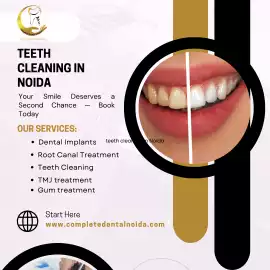 Expert Teeth Whitening in Noida, Noida