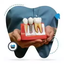 Get Affordable Dental Implants Treatment in Perth , Perth