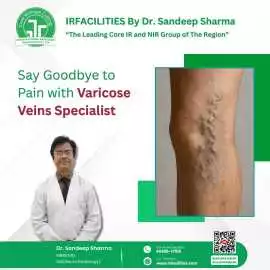 Expert Varicose Veins Specialist for Advanced Care, Chandigarh