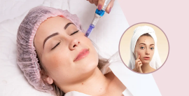 Benefits of Dermapen Microneedling for Acne, Delhi