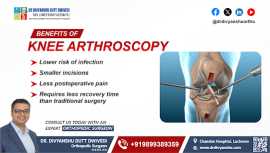 Benefits of Knee Arthoscopy by Dr Divyanshu Dutt , Lucknow