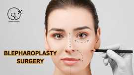 Best Blepharoplasty Surgery in Bangalore, Bengaluru