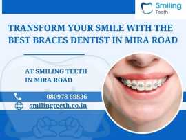 Transform Your Smile with the Best Braces Dentist , Mira Road