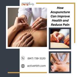 How Acupuncture Can Improve Health and Reduce Pain, Des Plaines