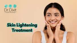 Best Skin Lightening Treatment in Bangalore, Bengaluru