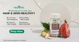 Are Hair and Skin Supplement Worth the Investment?, Noida