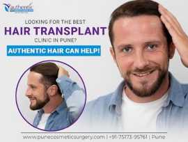 Looking for Best Hair Transplant Clinic in Pune?, Pune
