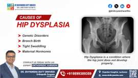 Causes of Hip dysplasia | Dr. Divyanshu Dutt , Lucknow