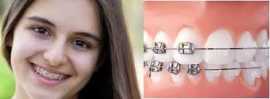 How can I find the best dentist clinic near me?, Jaipur