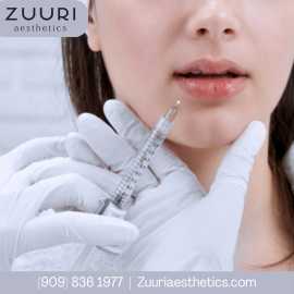 Lip Fillers Rancho Cucamonga | ZUURI Aesthetics, Rancho Cucamonga