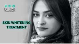 Skin Whitening Treatment in Bangalore, Bengaluru