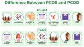 Homeopathy for Management of Weight Issues in PCOS, Noida