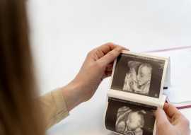 4d sonography in pregnancy, Ahmedabad