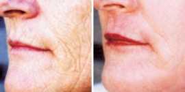 Advanced Skin Care and Laser Treatments, London
