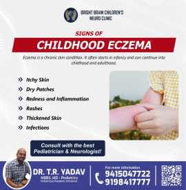 Is Your Child Suffering from Eczema?, Lucknow
