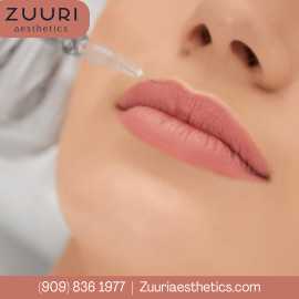 Lip Fillers Rancho Cucamonga | ZUURI Aesthetics, Rancho Cucamonga