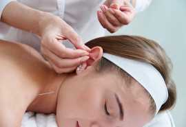 Acupuncture Clinic in Chicago , Chicago