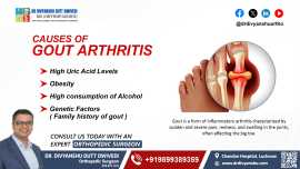 Gout Arthritis Treatment in Lucknow | Dr Divyanshu, Lucknow