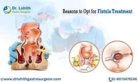 Get Expert Fistula Treatment in Bangalore, Bengaluru