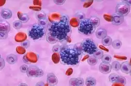 Understanding and Conquering B-Cell Lymphoma, Mississauga