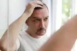 Call us +34-676 60 88 60 For Natural Hair Implants, Alicante