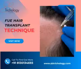 Get Natural Results with FUE Hair Transplant, Gurgaon