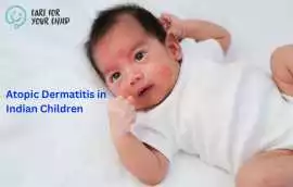 Atopic dermatitis in Indian Children, Mumbai