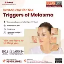 Laser Treatment For Birthmark Removal In India, Kurnool