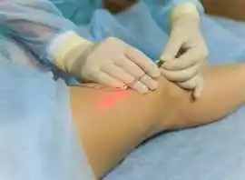 Find the Best Varicose Veins Specialist , Chandigarh