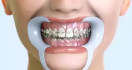 Advanced Orthodontic Treatment in Siliguri by Expe, Siliguri