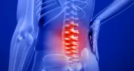 Expert Care for Ankylosing Spondylitis Patients in, Siliguri