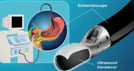 Expert Endoscopic Ultrasound Specialist in Siligur, Siliguri