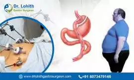 Best Bariatric Surgeon in Sarjapur Road, Bengaluru