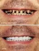 Cosmetic Dentistry in Rochdale Enhance Your Smile, Abberton